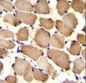 ARL17A Antibody - ARL17P1 Antibody immunohistochemistry of formalin-fixed and paraffin-embedded human skeletal muscle followed by peroxidase-conjugated secondary antibody and DAB staining.