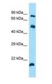 ARL4C Antibody - ARL4C / LAK antibody Western Blot of HT1080 Whole Cell lysates. Antibody Dilution: 1.0 ug/ml. There is BioGPS gene expression data showing that ARL4C is expressed in HT1080. Antibody dilution: 1 ug/ml.  This image was taken for the unconjugated form of this product. Other forms have not been tested.