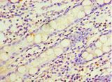 ARL4D Antibody - Immunohistochemistry of paraffin-embedded human rectum tissue using antibody at 1:100 dilution.  This image was taken for the unconjugated form of this product. Other forms have not been tested.