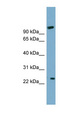 ARL8B Antibody - ARL8B / ARL8A antibody Western blot of COLO205 cell lysate. This image was taken for the unconjugated form of this product. Other forms have not been tested.