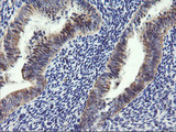 ARMC1 Antibody - IHC of paraffin-embedded Human endometrium tissue using anti-ARMC1 mouse monoclonal antibody.