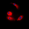 ARMC6 Antibody - Immunofluorescent analysis of ARMC6 staining in COLO205 cells. Formalin-fixed cells were permeabilized with 0.1% Triton X-100 in TBS for 5-10 minutes and blocked with 3% BSA-PBS for 30 minutes at room temperature. Cells were probed with the primary antibody in 3% BSA-PBS and incubated overnight at 4 C in a humidified chamber. Cells were washed with PBST and incubated with a DyLight 594-conjugated secondary antibody (red) in PBS at room temperature in the dark. DAPI was used to stain the cell nuclei (blue).