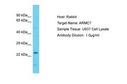 ARMC7 Antibody -  This image was taken for the unconjugated form of this product. Other forms have not been tested.