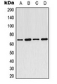 ARMCX2 Antibody - Western blot analysis of ARMCX2 expression in MCF7 (A); SP2/0 (B); PC12 (C); rat heart (D) whole cell lysates.