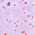 ARNT2 Antibody - Immunohistochemical analysis of ARNT2 staining in human brain formalin fixed paraffin embedded tissue section. The section was pre-treated using heat mediated antigen retrieval with sodium citrate buffer (pH 6.0). The section was then incubated with the antibody at room temperature and detected using an HRP conjugated compact polymer system. DAB was used as the chromogen. The section was then counterstained with hematoxylin and mounted with DPX.
