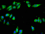 ARPC1A Antibody - Immunofluorescent analysis of Hela cells at a dilution of 1:100 and Alexa Fluor 488-congugated AffiniPure Goat Anti-Rabbit IgG(H+L)