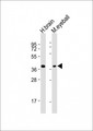 ARR3 / Cone Arrestin Antibody - All lanes: Anti-ARR3 Antibody (N-Term) at 1:2000 dilution. Lane 1: human brain lysate. Lane 2: mouse eyeball lysate Lysates/proteins at 20 ug per lane. Secondary Goat Anti-Rabbit IgG, (H+L), Peroxidase conjugated at 1:10000 dilution. Predicted band size: 43 kDa. Blocking/Dilution buffer: 5% NFDM/TBST.