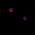ARRDC1 Antibody - Immunofluorescent analysis of ARRDC1 staining in MDAMB231 cells. Formalin-fixed cells were permeabilized with 0.1% Triton X-100 in TBS for 5-10 minutes and blocked with 3% BSA-PBS for 30 minutes at room temperature. Cells were probed with the primary antibody in 3% BSA-PBS and incubated overnight at 4 C in a humidified chamber. Cells were washed with PBST and incubated with a DyLight 594-conjugated secondary antibody (red) in PBS at room temperature in the dark. DAPI was used to stain the cell nuclei (blue).