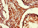 ARRDC1-AS1 / C9orf37 Antibody - Immunohistochemistry of paraffin-embedded human testis tissue using ARRDC1-AS1 Antibody at dilution of 1:100