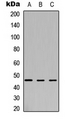 ARSB / Arylsulfatase B Antibody - Western blot analysis of Arylsulfatase B expression in HEK293T (A); NS-1 (B); H9C2 (C) whole cell lysates.