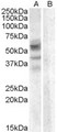 ARSD / Arylsulfatase D Antibody - Antibody (0.3 ug/ml) staining of A459 lysate (35 ug protein in RIPA buffer) with (B) and without (A) blocking with the immunizing peptide. Primary incubation was 1 hour. Detected by chemiluminescence