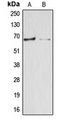 ARSE / Arylsulfatase E Antibody - Western blot analysis of Arylsulfatase E expression in HepG2 (A); HEK293T (B) whole cell lysates.