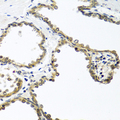 ARSF / Arylsulfatase F Antibody - Immunohistochemistry of paraffin-embedded human prostate.