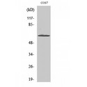 ARSI / Arylsulfatase I Antibody - Western blot of Arylsulfatase I antibody