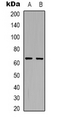 ARSI / Arylsulfatase I Antibody - Western blot analysis of Arylsulfatase I expression in HepG2 (A); COS7 (B) whole cell lysates.