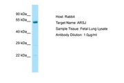 ARSJ / Arylsulfatase J Antibody -  This image was taken for the unconjugated form of this product. Other forms have not been tested.