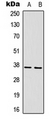 ART1 /CD296 Antibody - Western blot analysis of CD296 expression in HepG2 (A); mouse brain (B) whole cell lysates.