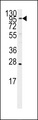 ARTS1 / ERAP1 Antibody - Western blot of anti-ARTS1 Antibody in Ramos cell line lysates (35 ug/lane). ARTS1 (arrow) was detected using the purified antibody.