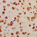 ARTS1 / ERAP1 Antibody - Immunohistochemical analysis of ERAP1 staining in human brain formalin fixed paraffin embedded tissue section. The section was pre-treated using heat mediated antigen retrieval with sodium citrate buffer (pH 6.0). The section was then incubated with the antibody at room temperature and detected using an HRP conjugated compact polymer system. DAB was used as the chromogen. The section was then counterstained with hematoxylin and mounted with DPX.