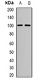 ASAH2 Antibody - Western blot analysis of Neutral Ceramidase expression in mouse kidney (A); mouse heart (B) whole cell lysates.