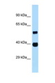 ASB4 Antibody - ASB4 antibody Western blot of Fetal Heart lysate. Antibody concentration 1 ug/ml.  This image was taken for the unconjugated form of this product. Other forms have not been tested.