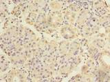 ASB8 Antibody - Immunohistochemistry of paraffin-embedded human pancreatic tissue using antibody at dilution of 1:100.