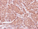 ASB9 Antibody - IHC of paraffin-embedded A549 xenograft using ASB9 antibody at 1:500 dilution.