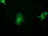 ASCC2 Antibody - Anti-ASCC2 mouse monoclonal antibody immunofluorescent staining of COS7 cells transiently transfected by pCMV6-ENTRY ASCC2.