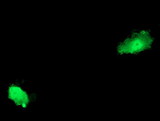 ASCC2 Antibody - Anti-ASCC2 mouse monoclonal antibody immunofluorescent staining of COS7 cells transiently transfected by pCMV6-ENTRY ASCC2.