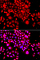 ASCC3 Antibody - Immunofluorescence analysis of A549 cells.