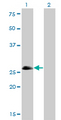 ASCL1 / MASH1 Antibody - Western Blot analysis of ASCL1 expression in transfected 293T cell line by ASCL1 monoclonal antibody (M01), clone 7E11.Lane 1: ASCL1 transfected lysate(25.5 KDa).Lane 2: Non-transfected lysate.