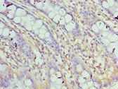 ASF1A Antibody - Immunohistochemistry of paraffin-embedded human rectum tissue using antibody at 1:100 dilution.