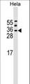 ASF1A Antibody - ASF1A Antibody western blot of HeLa cell line lysates (35 ug/lane). The ASF1A antibody detected the ASF1A protein (arrow).