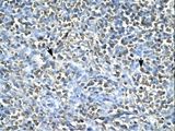 ASGR2 Antibody - ASGR2 antibody ARP33821_T100-NP_001172-ASGR2 (asialoglycoprotein receptor 2) Antibody was used in IHC to stain formalin-fixed, paraffin-embedded human spleen.  This image was taken for the unconjugated form of this product. Other forms have not been tested.