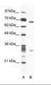 ASH2L / ASH2 Antibody - A: Marker, B: Jurkat Cell Lysate.  This image was taken for the unconjugated form of this product. Other forms have not been tested.