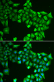 ASL / Argininosuccinate Lyase Antibody - Immunofluorescence analysis of HeLa cells.