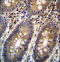 ASMTL Antibody - ASMTL Antibody immunohistochemistry of formalin-fixed and paraffin-embedded human colon tissue followed by peroxidase-conjugated secondary antibody and DAB staining.