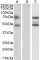 ASNSD1 Antibody - HEK293 lysate (10ug protein in RIPA buffer) overexpressing Human ASNSD1 with DYKDDDDK tag probed with (1ug/ml) in Lane A and probed with anti-DYKDDDDK Tag (1/10000) in lane C. Mock-transfected HEK293 probed (1mg/ml) in Lane B. Primary