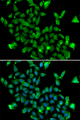 ASPA Antibody - Immunofluorescence analysis of MCF7 cells.