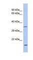 ASPDH Antibody - ASPDH antibody Western blot of Fetal Spleen lysate. This image was taken for the unconjugated form of this product. Other forms have not been tested.