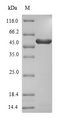 3-Phytase A Protein - (Tris-Glycine gel) Discontinuous SDS-PAGE (reduced) with 5% enrichment gel and 15% separation gel.
