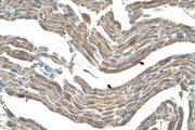 ASPN / Asporin Antibody - ASPN / Asporin antibody ARP42487_T100-NP_060150-ASPN(asporin) Antibody IHC of formalin-fixed, paraffin-embedded human Muscle. Positive label: Skeletal muscle cells indicated with arrows. Antibody concentration 4-8 ug/ml. Magnification 400X.  This image was taken for the unconjugated form of this product. Other forms have not been tested.