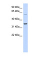 ASPRV1 / SASPase Antibody - ASPRV1 antibody Western blot of Fetal Lung lysate. This image was taken for the unconjugated form of this product. Other forms have not been tested.