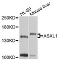 ASXL1 Antibody - Western blot analysis of extracts of various cells.