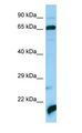 ATAD3A Antibody - ATAD3A antibody Western Blot of Fetal Liver.  This image was taken for the unconjugated form of this product. Other forms have not been tested.