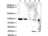 ATAD5 / ELG1 Antibody - Anti-Elg1 Antibody - Western Blot. Western blot of Affinity Purified anti-Elg1 antibody shows detection of a band ~120 kD corresponding to human Elg1 (arrowhead) in various cell lysates. Lanes contain ~5 ug of HeLa nuclear extract (1), HeLa (2), A431 (3), Jurkat (4) and HEK293 (5) whole cell lysates. After SDS-PAGE, transfer and blocking, the membrane was probed with the primary antibody diluted to 1:500. The membrane was then washed and reacted with a HRP conjugated Gt-a-Rabbit IgG [H&L] MX followed by ECL detection using a 2 m exposure time. The expected molecular weight of Elg1 is 120kD according to Kanellis P et al. 2003, although the predicted molecular weight is 207 kD. The 50kD bands in Jurkat and 293 cell lysates are probably cross-reaction with other proteins. Both the 120 kD and 50 kD bands are not observed when antibody is pre-incubated with peptide (data not shown).