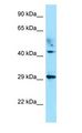 ATCAY / CLAC Antibody - ATCAY / CLAC antibody Western Blot of Fetal Thymus.  This image was taken for the unconjugated form of this product. Other forms have not been tested.