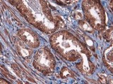 ATF3 Antibody - Immunohistochemistry: ATF3 Antibody - Analysis of ATF3 in human prostate using Fast Red with hematoxylin counterstain.  This image was taken for the unconjugated form of this product. Other forms have not been tested.