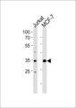 ATF4 Antibody - ATF4 Antibody western blot of Jurkat,MCF-7 cell line lysates (35 ug/lane). The ATF4 antibody detected the ATF4 protein (arrow).