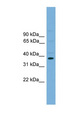 ATF4 Antibody - ATF4 antibody Western blot of Mouse Brain lysate. This image was taken for the unconjugated form of this product. Other forms have not been tested.